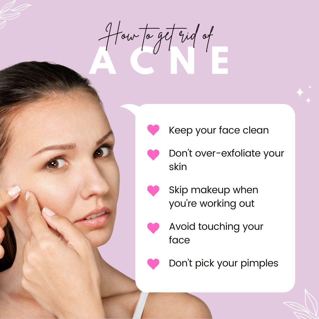 Effective Ways To Get Rid Of Acne — Sorich 